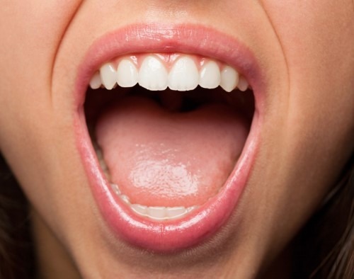 Mundgeruch beim öffnen des Mundes (Halitosis)